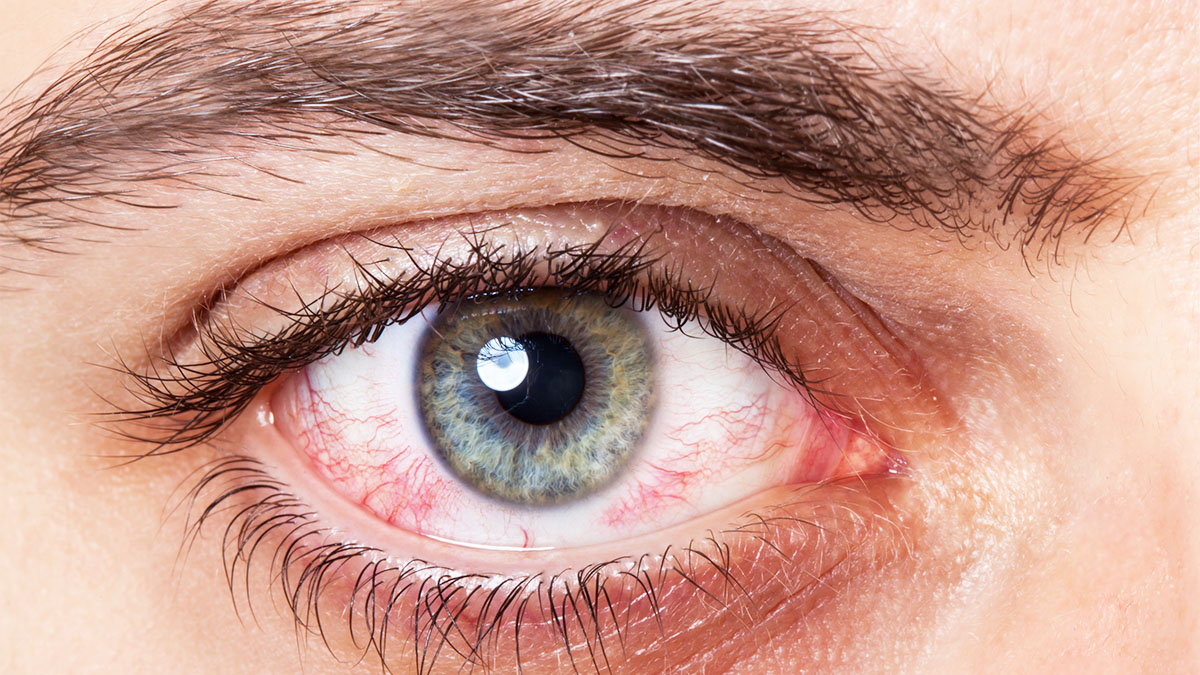 Ngjyra dhe forma e syve, tregues të rëndësishëm të shëndetit të njeriut! Ja sinjalet që tregojnë